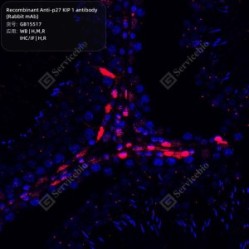 Recombinant Anti-p27 KIP 1 antibody (Rabbit mAb)