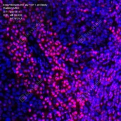 Recombinant Anti-p27 KIP 1 antibody (Rabbit mAb)