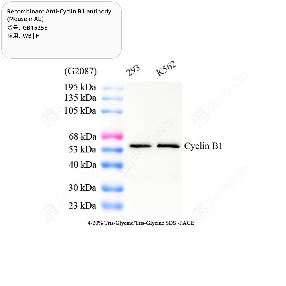 Recombinant Anti-Cyclin B1 antibody (Mouse mAb)