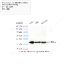 Recombinant Anti-CDKN2A/p16INK4a antibody (Rabbit mAb)