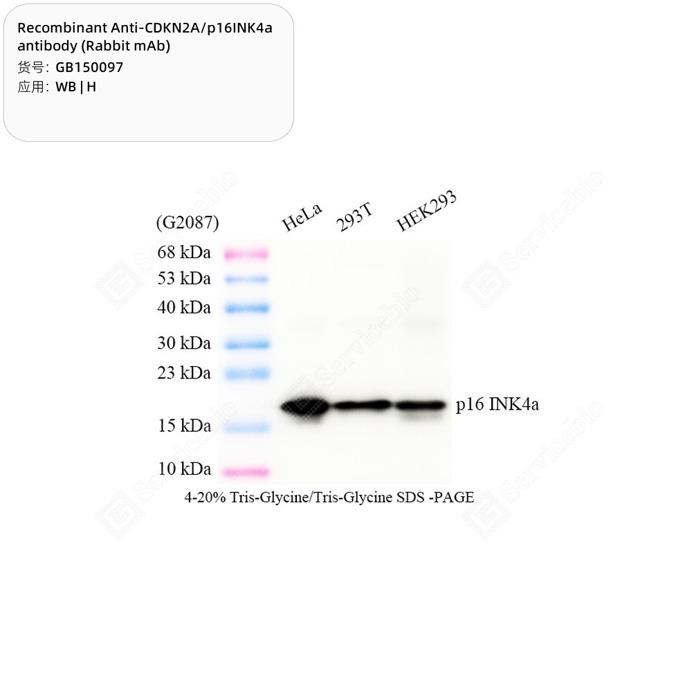 Recombinant Anti-CDKN2A/p16INK4a antibody (Rabbit mAb)