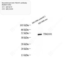 Recombinant Anti-TSG101 antibody (Rabbit mAb)
