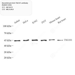 Recombinant Anti-TSG101 antibody (Rabbit mAb)