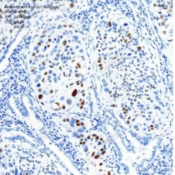 Recombinant Anti-p21 antibody (Rabbit mAb)