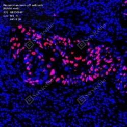 Recombinant Anti-p21 antibody (Rabbit mAb)