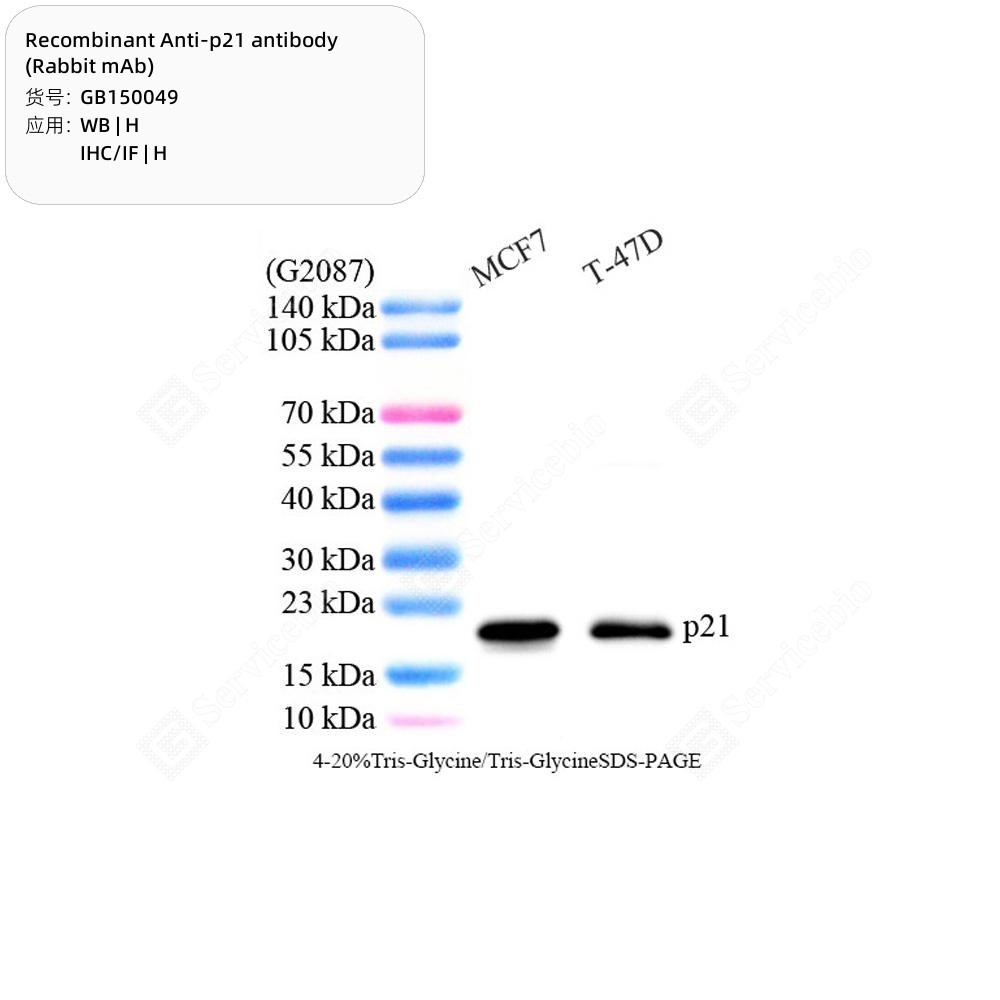 Recombinant Anti-p21 antibody (Rabbit mAb)