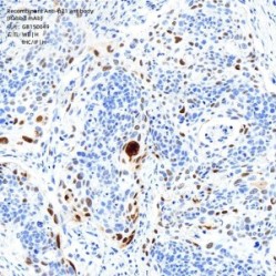 Recombinant Anti-p21 antibody (Rabbit mAb)