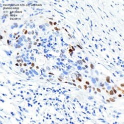 Recombinant Anti-p21 antibody (Rabbit mAb)