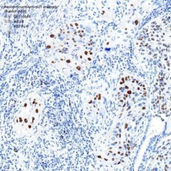 Recombinant Anti-p21 antibody (Rabbit mAb)