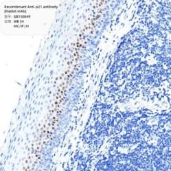 Recombinant Anti-p21 antibody (Rabbit mAb)