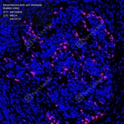Recombinant Anti-p21 antibody (Rabbit mAb)