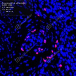 Recombinant Anti-p21 antibody (Rabbit mAb)
