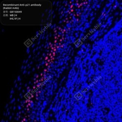 Recombinant Anti-p21 antibody (Rabbit mAb)