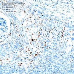 Recombinant Anti-p21 antibody (Rabbit mAb)