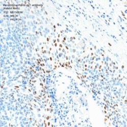 Recombinant Anti-p21 antibody (Rabbit mAb)