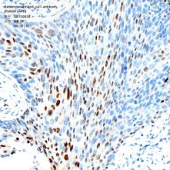 Recombinant Anti-p21 antibody (Rabbit mAb)