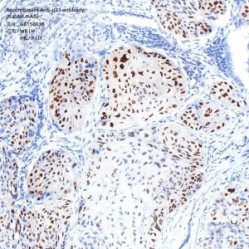 Recombinant Anti-p21 antibody (Rabbit mAb)