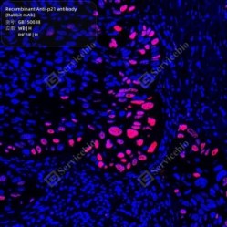 Recombinant Anti-p21 antibody (Rabbit mAb)