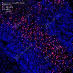 Recombinant Anti-p21 antibody (Rabbit mAb)