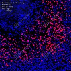 Recombinant Anti-p21 antibody (Rabbit mAb)
