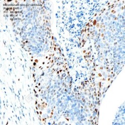 Recombinant Anti-p21 antibody (Rabbit mAb)