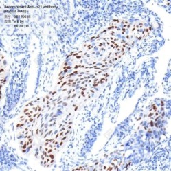 Recombinant Anti-p21 antibody (Rabbit mAb)
