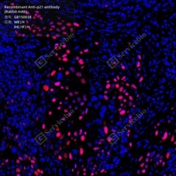 Recombinant Anti-p21 antibody (Rabbit mAb)