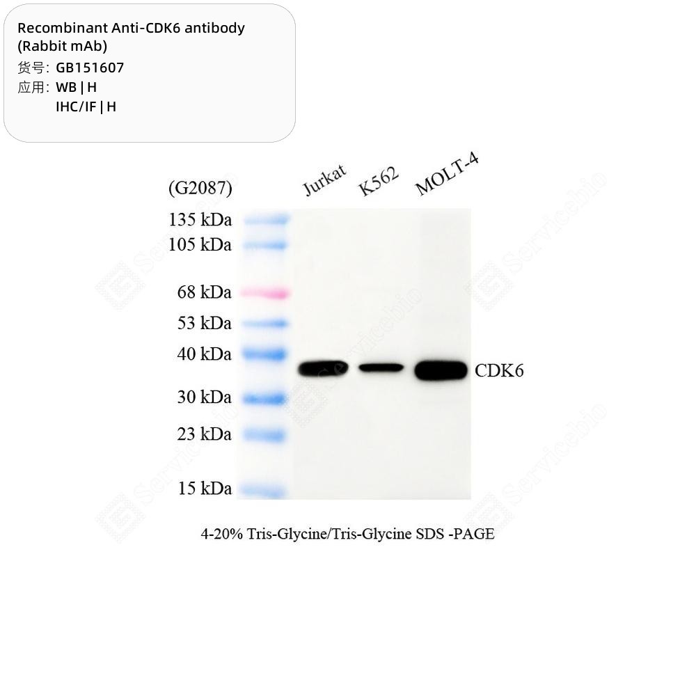 Recombinant Anti-CDK6 antibody (Rabbit mAb)