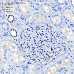 Recombinant Anti-CDK6 antibody (Rabbit mAb)