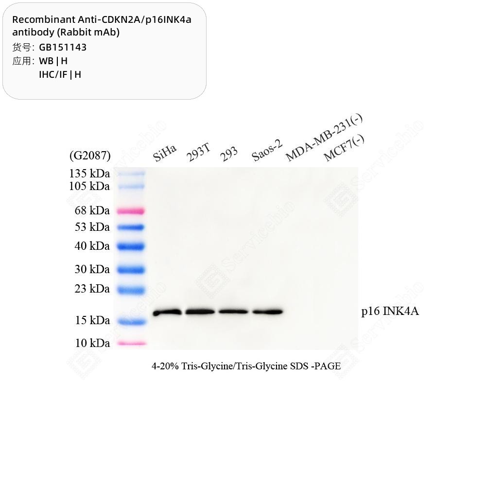 Recombinant Anti-CDKN2A/p16INK4a antibody (Rabbit mAb)