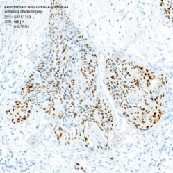 Recombinant Anti-CDKN2A/p16INK4a antibody (Rabbit mAb)