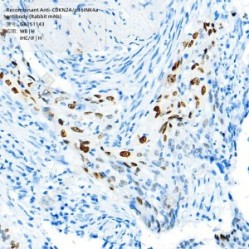 Recombinant Anti-CDKN2A/p16INK4a antibody (Rabbit mAb)