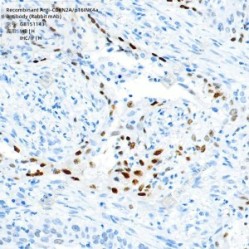 Recombinant Anti-CDKN2A/p16INK4a antibody (Rabbit mAb)