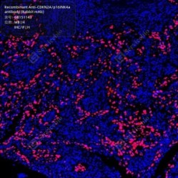 Recombinant Anti-CDKN2A/p16INK4a antibody (Rabbit mAb)