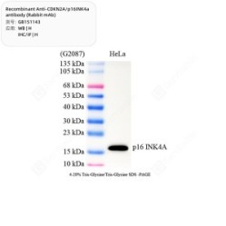 Recombinant Anti-CDKN2A/p16INK4a antibody (Rabbit mAb)