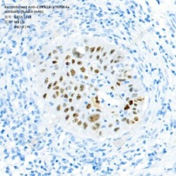 Recombinant Anti-CDKN2A/p16INK4a antibody (Rabbit mAb)