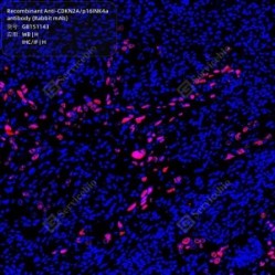 Recombinant Anti-CDKN2A/p16INK4a antibody (Rabbit mAb)