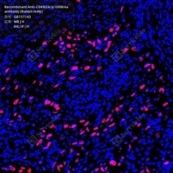 Recombinant Anti-CDKN2A/p16INK4a antibody (Rabbit mAb)