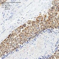 Recombinant Anti-CDK6 antibody (Rabbit mAb)