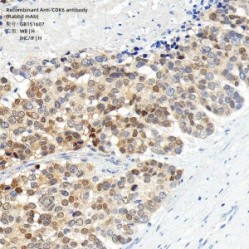 Recombinant Anti-CDK6 antibody (Rabbit mAb)