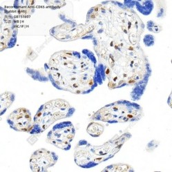 Recombinant Anti-CDK6 antibody (Rabbit mAb)