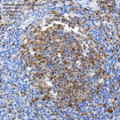 Recombinant Anti-CDK6 antibody (Rabbit mAb)