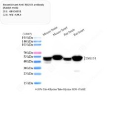 Recombinant Anti-TSG101...