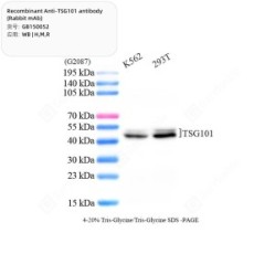 Recombinant Anti-TSG101 antibody (Rabbit mAb)
