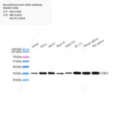 Recombinant Anti-CDK4...