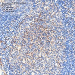 Recombinant Anti-CDK4 antibody (Rabbit mAb)