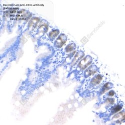 Recombinant Anti-CDK4 antibody (Rabbit mAb)