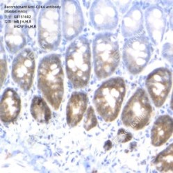 Recombinant Anti-CDK4 antibody (Rabbit mAb)