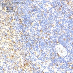 Recombinant Anti-CDK4 antibody (Rabbit mAb)