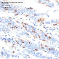 Recombinant Anti-Cyclin A2 antibody (Rabbit mAb)